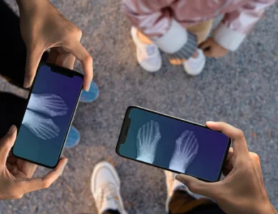 Veja seu raio-x pelo celular - Saiba Como!